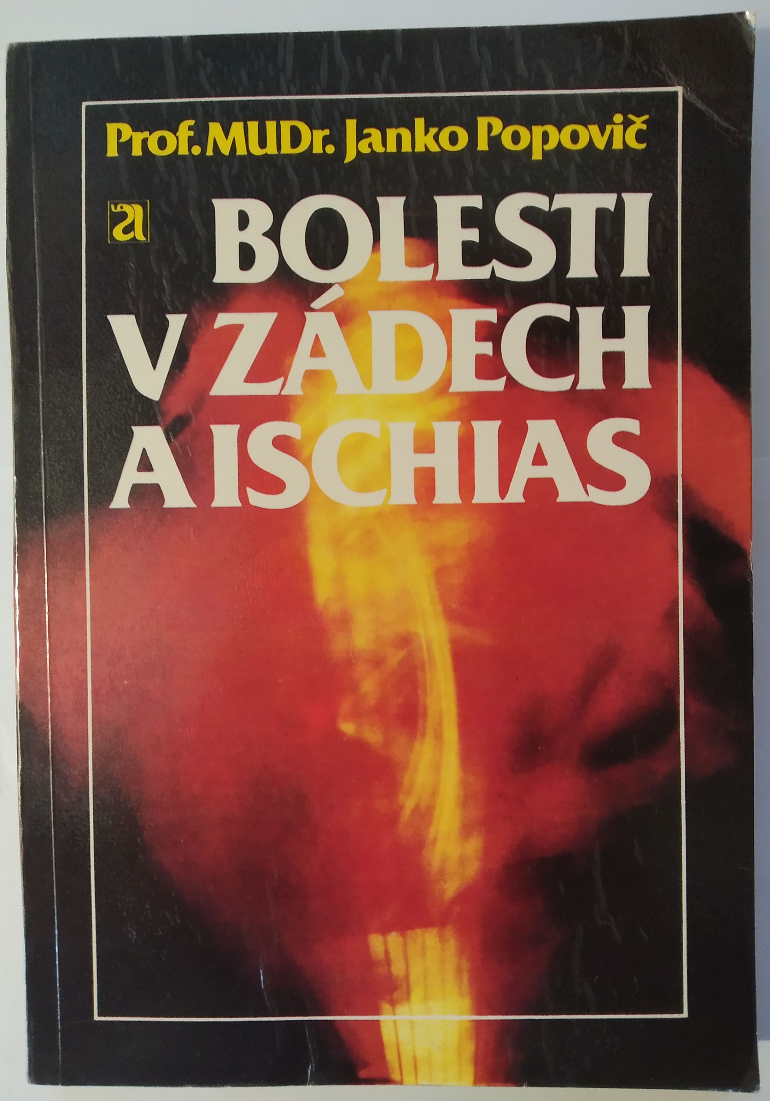 Bolesti v zádech a ischias