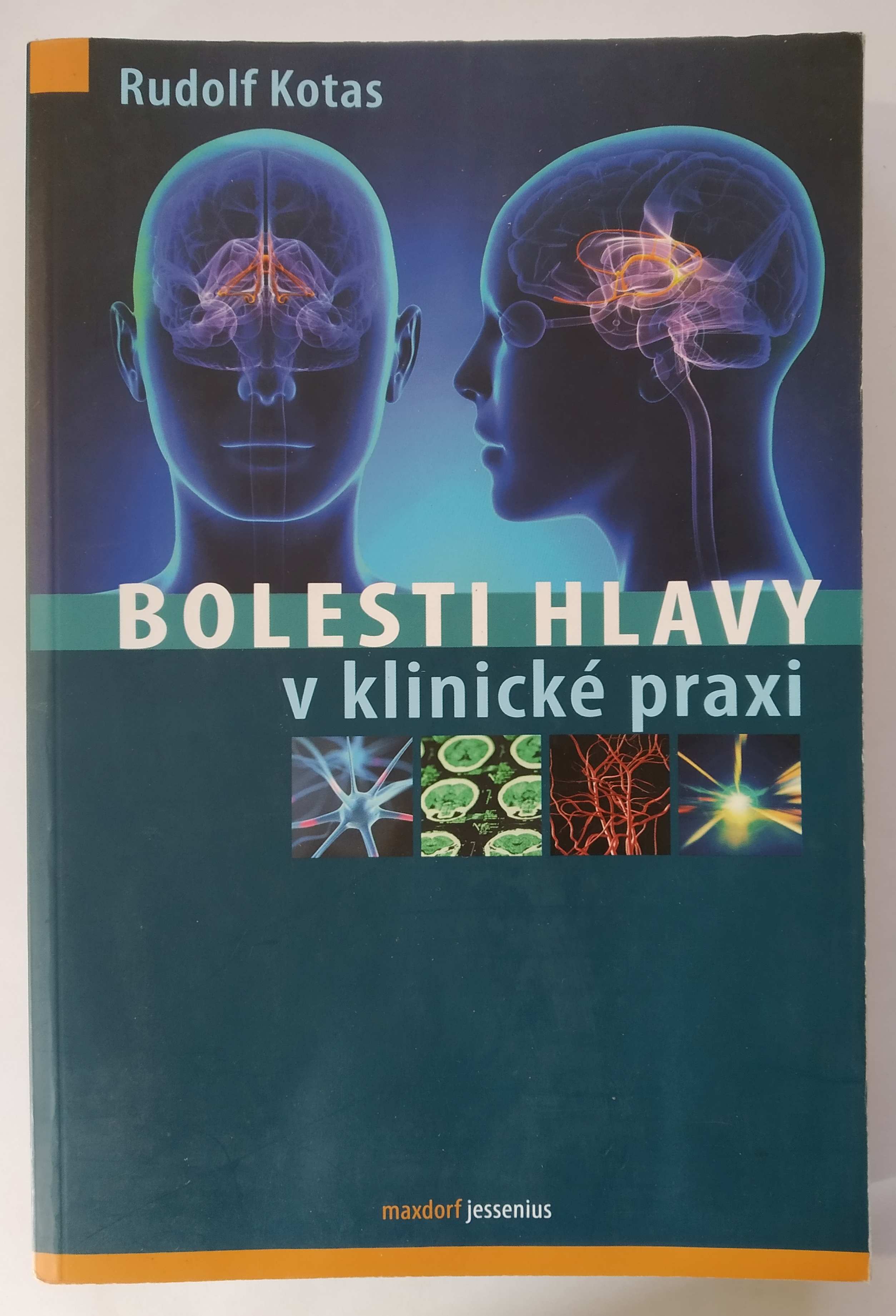 Bolesti hlavy v klinické praxi